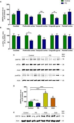 GRP78 Level Is Altered in the Brain, but Not in Plasma or Cerebrospinal Fluid in Parkinson’s Disease Patients